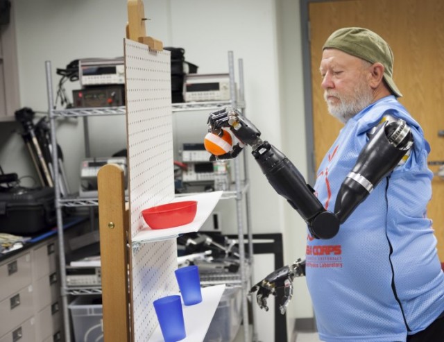 mind-controlled-prosthetics